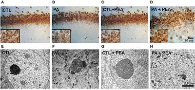 Palmitoylethanolamide Ameliorates Hippocampal Damage and Behavioral Dysfunction After Perinatal Asphyxia in the Immature Rat Brain